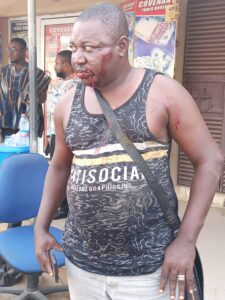 Awutu Senya East Constituency Secretary of the Nat. Democratic Congress beaten by MP thugs